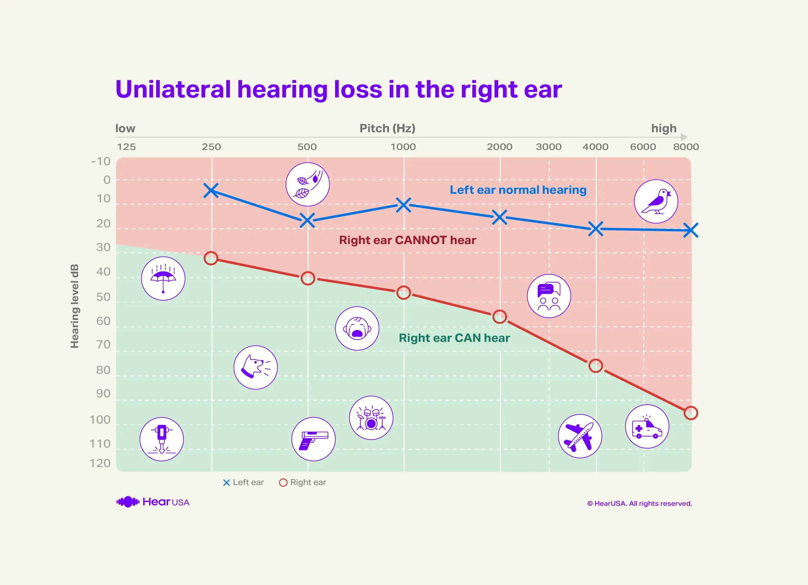 Unilateral audiogram